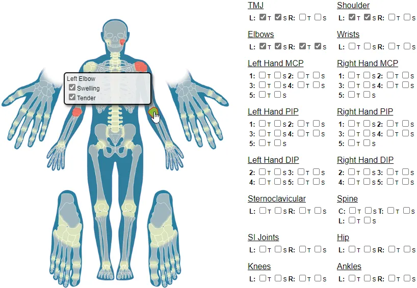 Skeleton Joints